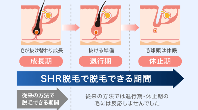 毛の生え変わりサイクル